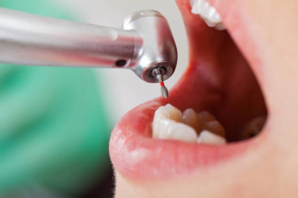 Best Weekend Emergency Dentist in Monument, CO